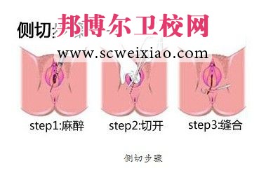 女性内生殖器及其功能——阴道